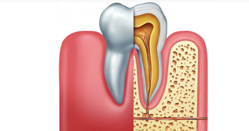 Retratamento de Canal - Dentista Porto Alegre, Clinica Odontológica Porto Alegre