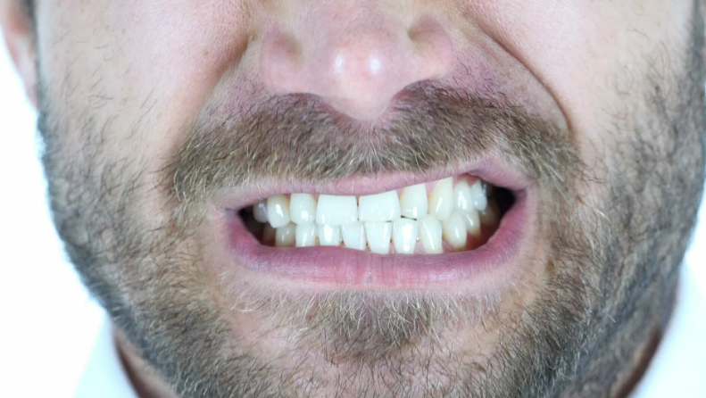 Bruxismo- Dentista Porto Alegre, Clinica Odontológica Porto Alegre